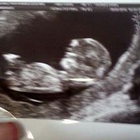 Teresa Doherty Photo 28