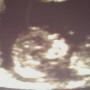 Rachel Mcclain Photo 18