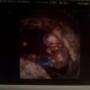 Jackie Scott Photo 14