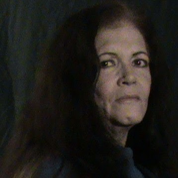 Ann Burnette Photo 23