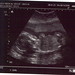 Emily Weeks Photo 22