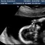 Rosalyn Ramirez Photo 16