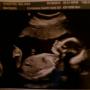 Melissa Overton Photo 31