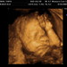 Marcus Norman Photo 28