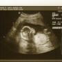 Erin Garrett Photo 20