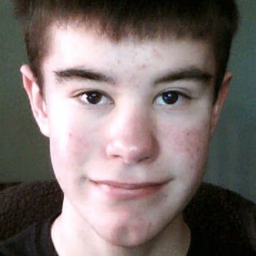 Joseph Brunner Photo 29