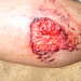 Danny Hurt Photo 33