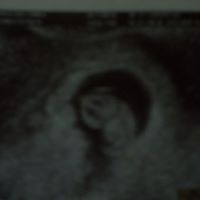 Amy Rivas Photo 25