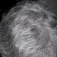 Gilbert Dupuis Photo 2