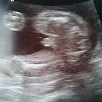 Lucy James Photo 39