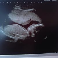 Sean Bergin Photo 12