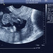 Nathaniel Oliver Photo 29