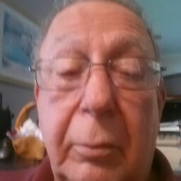 Larry Matlock Photo 5
