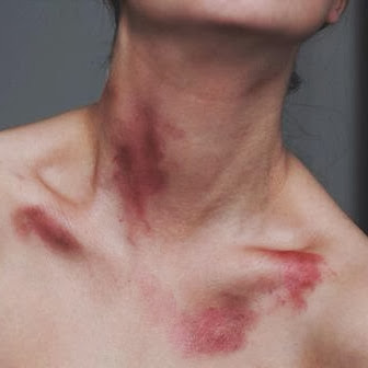 Julia Sykes Photo 23
