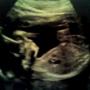 Ryan Krause Photo 35