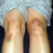 Michelle Knee Photo 11