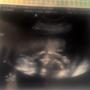 Elizabeth Clemons Photo 28