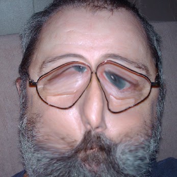 John Ruby Photo 30