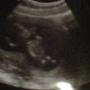 Megan Rowe Photo 15
