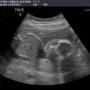 Julie Treadway Photo 15
