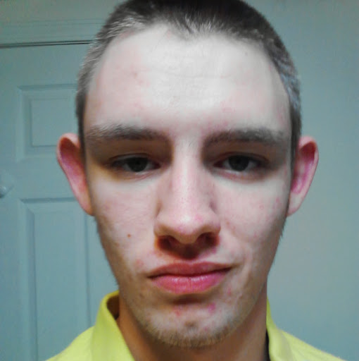 Dale Sisson Photo 15