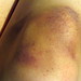 Michelle Knee Photo 10