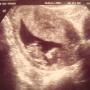 Lindsay Spurlock Photo 15
