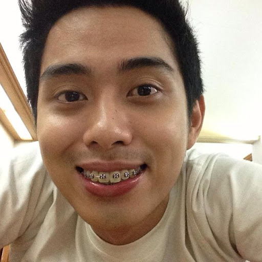 Johnny Lim Photo 24