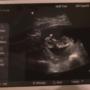 Lisa Arndt Photo 24