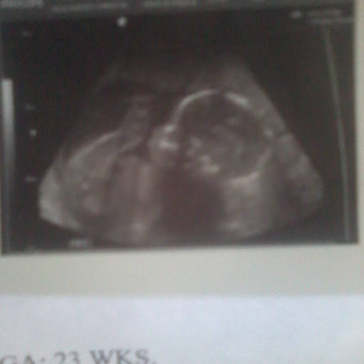 Christal Alexander Photo 2