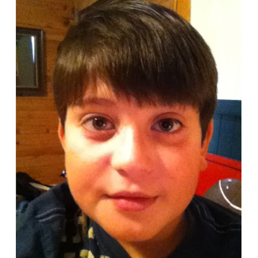 Mark Herzberg Photo 5