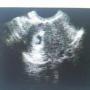 Alicia Case Photo 20