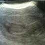 Heather Phillips Photo 23