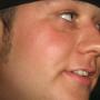 Blake Parker Photo 20