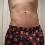 Dean Lynch Photo 16