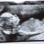 Elizabeth Steele Photo 21