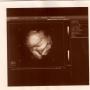 Darlene Long Photo 30