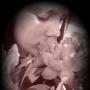 Rachel Whitten Photo 20