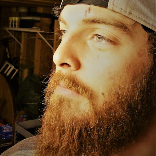 Dustin Rhoads Photo 27