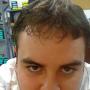 Tyler Hill Photo 9