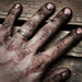 Albert Hand Photo 9
