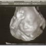 Frances Gross Photo 33