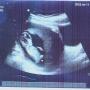 Elizabeth Dietz Photo 14