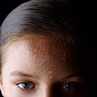Barbara Andersen Photo 27