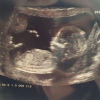 Staci Whiting Photo 1