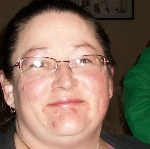 Teresa Matthews Photo 34