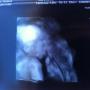 Debra Belcher Photo 19