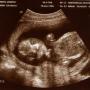 Jennifer Garceau Photo 12