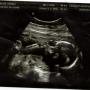 Jason Kuntz Photo 25