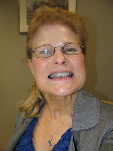 Joyce Stephens Photo 4